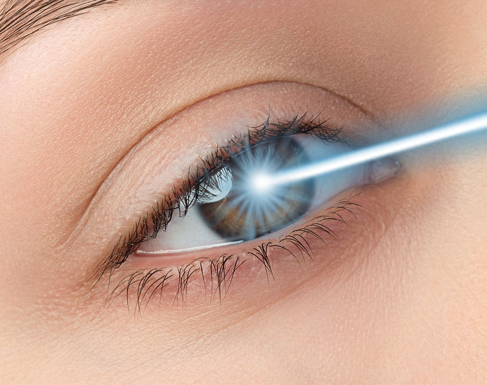 Posso escolher entre LASIK e PRK?